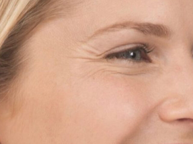 Before - puredental
