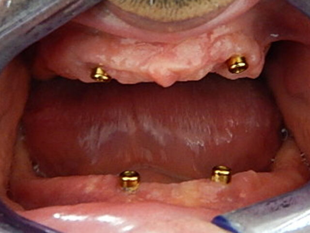 Before - puredental