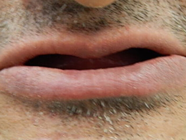 Before - puredental