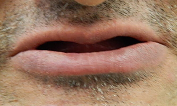 Before - puredental