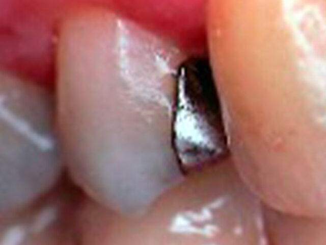 Before - puredental
