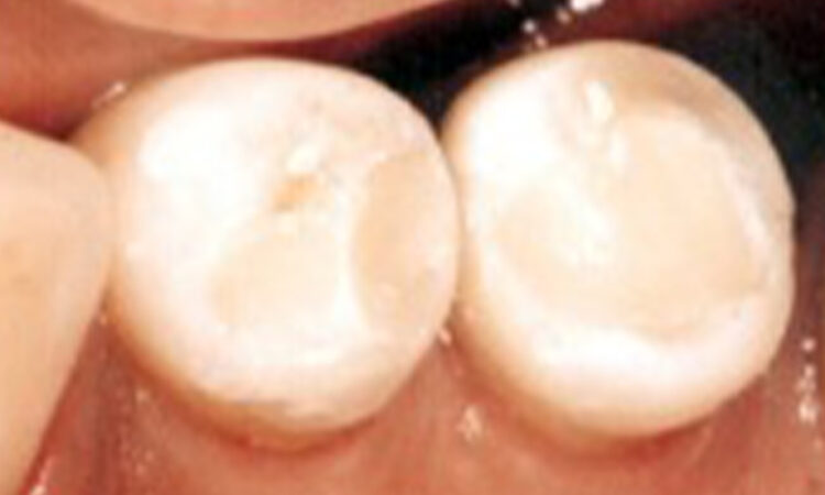 After - puredental