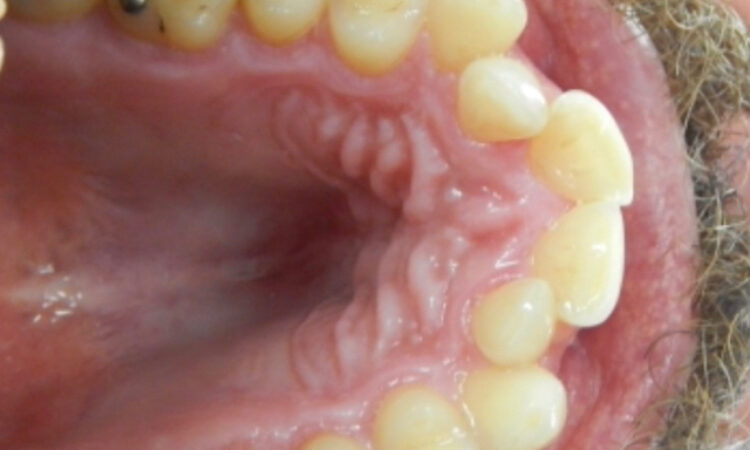 Before - puredental